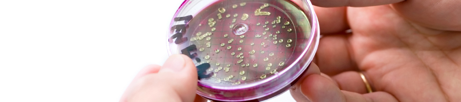 Hand holding a Petri dish